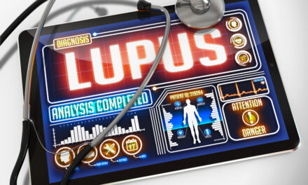 Environmental Exposures & Lupus: Is There a Connection?