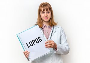 The Research Study on lupus